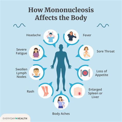 are mono symptoms similar to covid 19